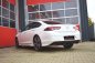 Preview: Friedrich Motorsport 76mm Duplex-Anlage Opel Insignia Grand Sport Frontantrieb 991114T-x3-X